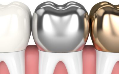 Dental Crowns and Bridges: Your Comprehensive Guide