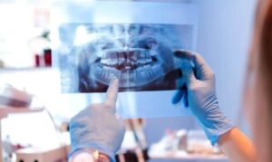 Dental X-rays and diagnostics