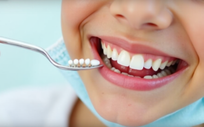 Fluoride Treatments: Secret to Healthy Smiles